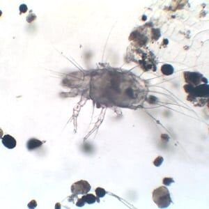 dust mites under microscope